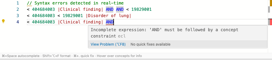 Real-time error diagnostics with inline messages showing syntax and semantic errors